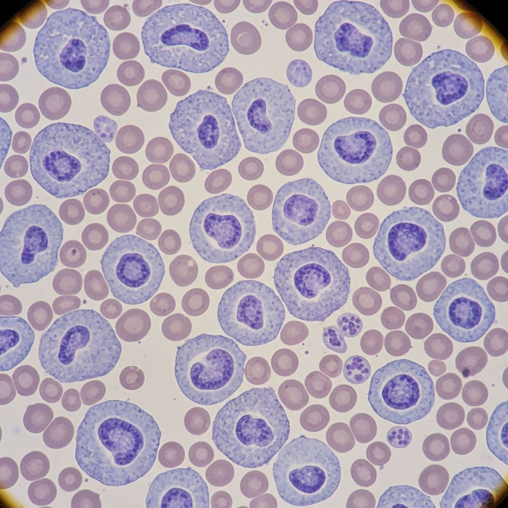 What Ibrutinib Is and How It Works in Blood Cancers